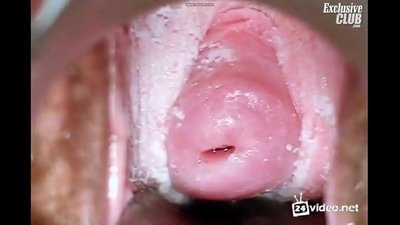 Gynecological kuongorora kwemukadzi akanaka